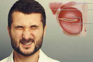 блефароспазм