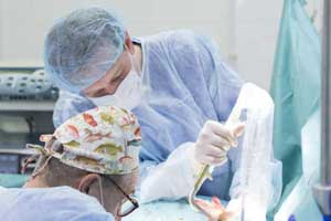 рак полового члена