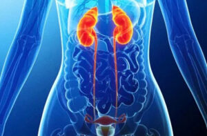 Лечение рака мочеточника в Израиле