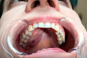 180122-rak-chelyusti-hospitalbooking-com