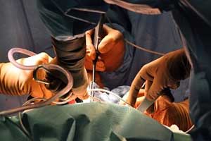 остеобластома позвоночника