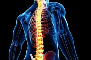 остеобластома позвоночника