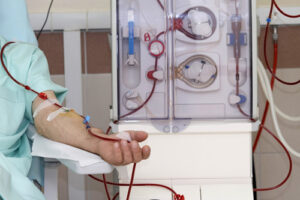 Терапевтическая плазмаферез