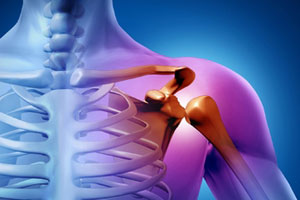 саркома Юинга