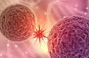 Лечение медуллобластомы