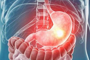 гастринома