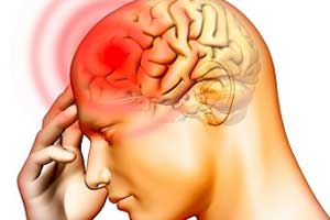 арахноидит