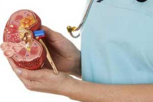 рак почечной лоханки