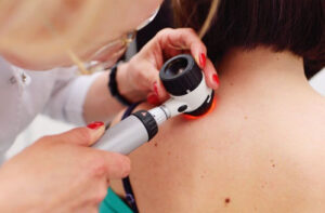 Лечение синдрома Сезари в Израиле