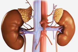 Альдостерома