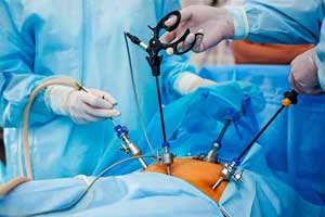 Хориокарцинома