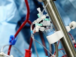 Экстракорпоральная гемосорбция