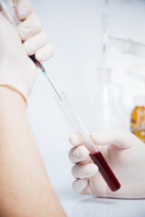 Диагностика рака крови в Израиле