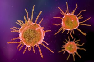 Лечение опухолей головного мозга в Израиле