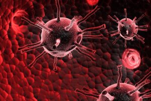 Лечение саркомы в Израиле