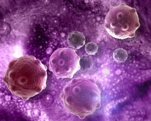 Лечение рака почки в Германии: применение инновационных форм терапии