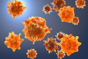 Лечение глиомы в Германии