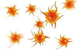 Лечение рака желудка в Израиле