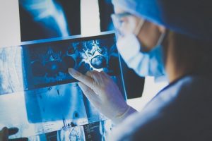 Диагностика рака в Германии