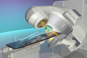 Лучевая терапия в Израиле