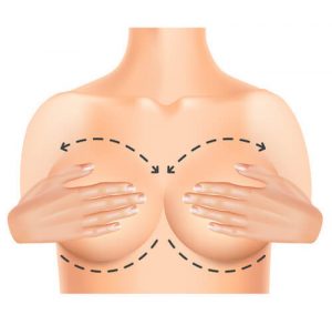 Маммопластика в Израиле: отличный результат по доступной цене