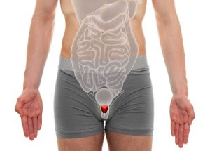 Лечение простатита в Израиле