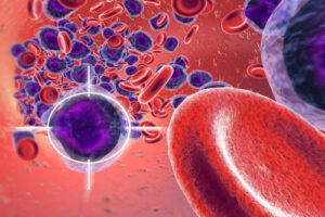 миелолейкоз