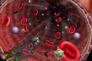 Лечение гемобластозов в немецких клиниках, прогрессивные методы противоопухолевой терапии, таргетная терапия, CAR-T-терапия, трансплантация костного мозга, диагностика на высокотехнологичном оборудовании. Квалифицированные врачи, комфортные условия, умеренные цены