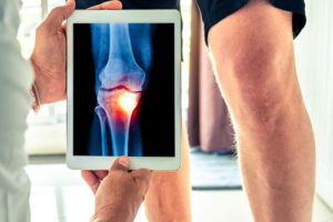 остеобластома