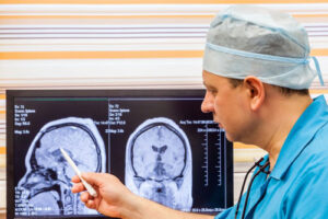 эстезионейробластома