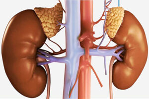 рак надпочечников