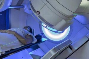 лечение рака носоглотки