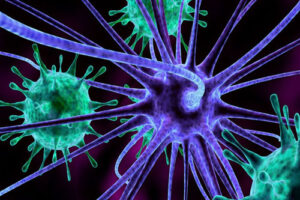 нейрофиброма