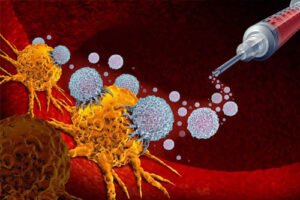 лечение рака гортани