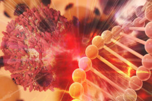 лечение рака желчного пузыря