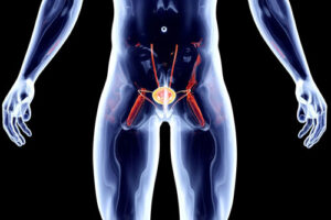 рак простаты