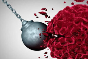 лечение меланомы