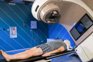 лечение глиобластомы