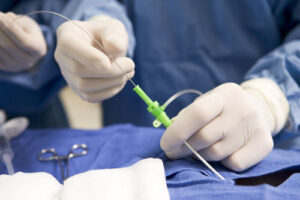 лечение карциномы почек