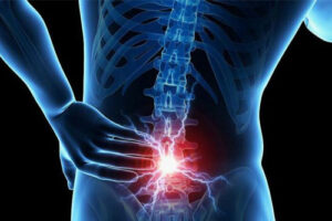 опухоли позвоночника