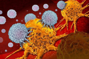 лечение нейробластомы