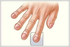 муковисцидоз