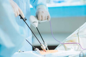 лечение псевдомиксомы брюшины