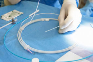 лечение аневризмы аорты