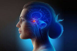 пролактинома