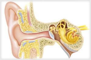 Болезнь Меньера