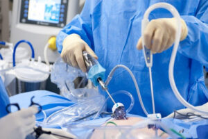 киста Торнвальда лечение