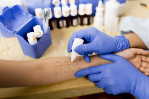 сенная лихорадка лечение