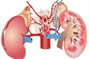 амилоидоз почек