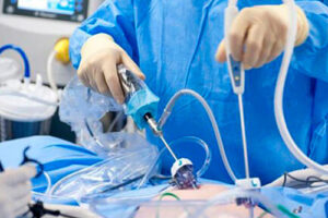 дистопия почки лечение